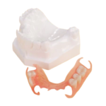 Dental Demo Flexible Partial Denture Model