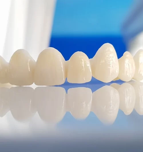 zirconia-crown.jpg